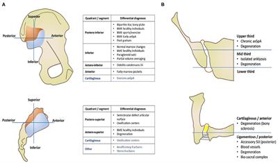 Axial Spondyloarthritis: Mimics and Pitfalls of Imaging Assessment